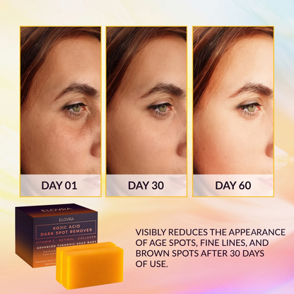 ELOVRA- Kojic Acid Soap Bar